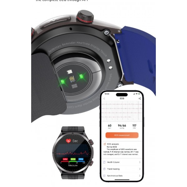 Smart Watch Air Pump Bluetooth Call Blood Glucose Blood Lipids Uric Acid Temperature ECG Sleep